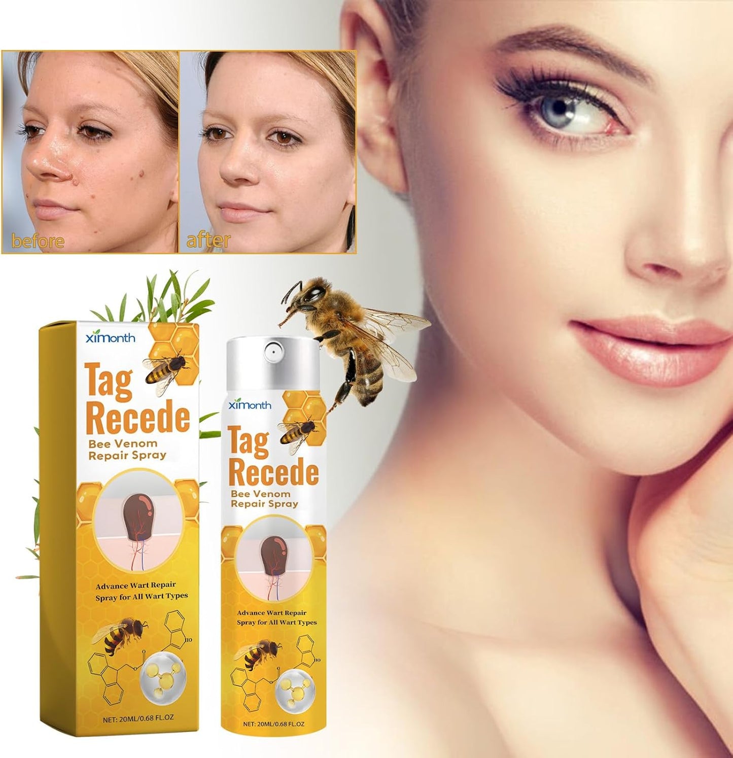 Tag Recede Bee Venom, TagRecede Bee Venom Treatment Spray (1 Piece)